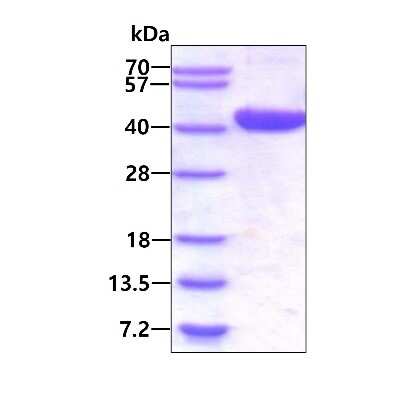 SDS-PAGE: Recombinant Human LCMT1 His Protein [NBP1-78845]